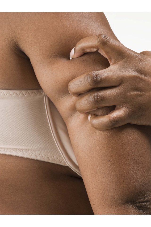 Woman pinching fat on arm